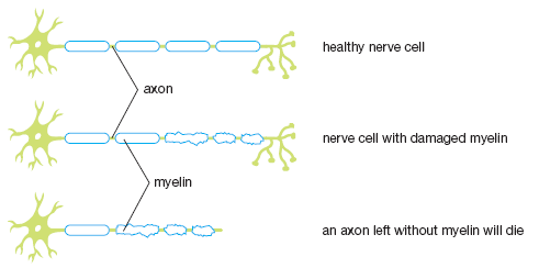 diagram of damage to a nerve cell