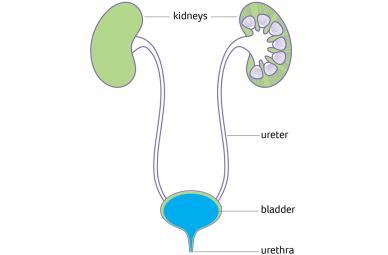 Urinary tract diagram showing kidneys, ureters, bladder, urethra