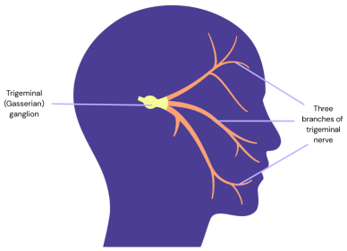Diagram showing side profile of face with three trigeminal nerve branches and trigeminal ganglion