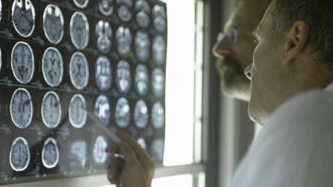 Neurologists reviewing scans
