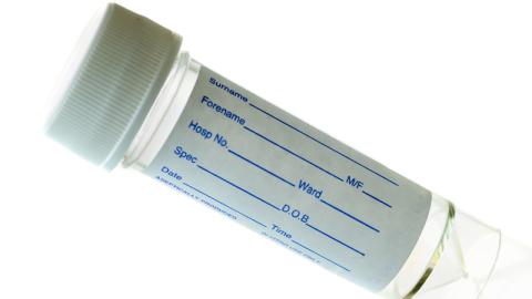 urine specimen container