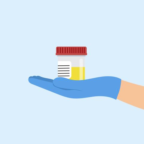 urine test pot