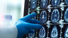 Image of brain scans