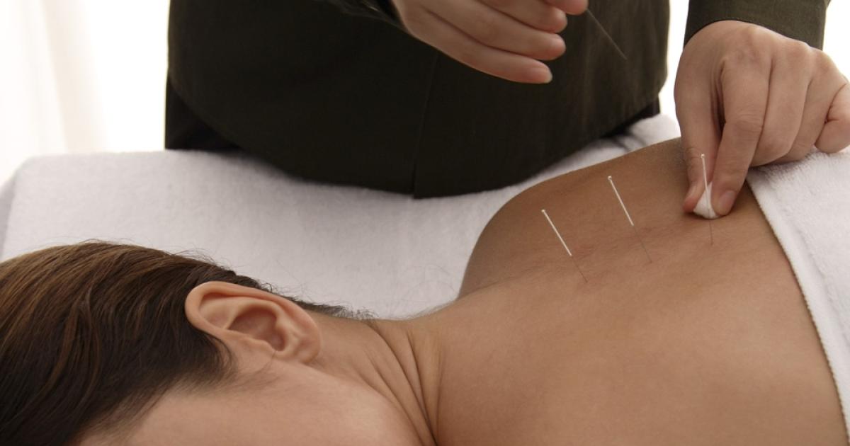 Acupuncture | MS Trust