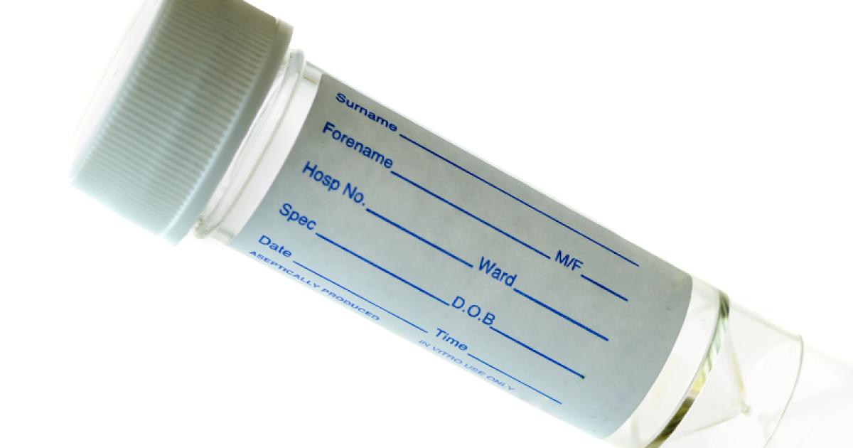 Ruth’s Lockdown Project Home MSU test kit MS Trust